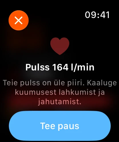 Nutikas pulsihoiatus Apple Watch
