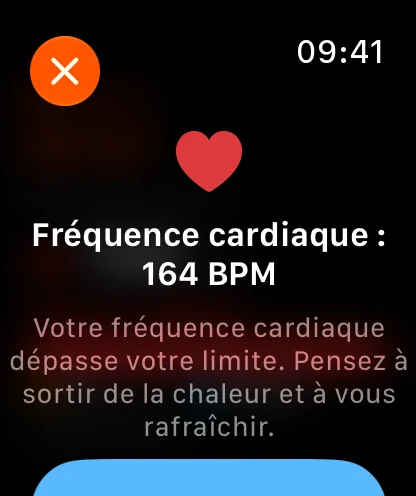 Alerte cardiaque Apple Watch